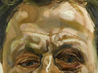black eye